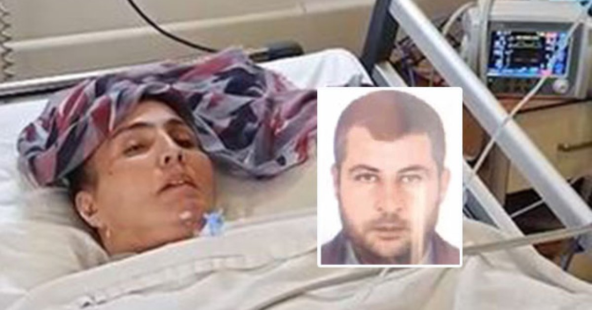 Kan donduran şiddet! 54 gün oldu… Makineyle yaşıyor!